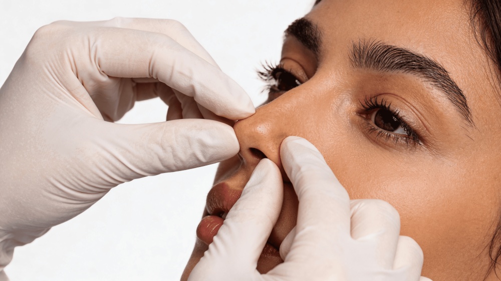 Obstrucción nasal: causas, síntomas y cómo tratarlas con rinoplastia funcional
