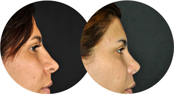 Contorno craneofacial - Medellin, Colombia - Dr. Alvaro Correa J